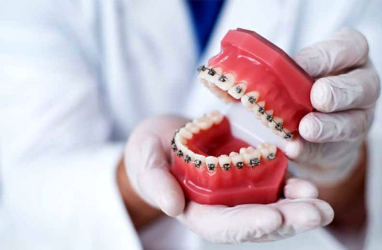 پرینتر سه بعدی در براکت دندانپزشکی